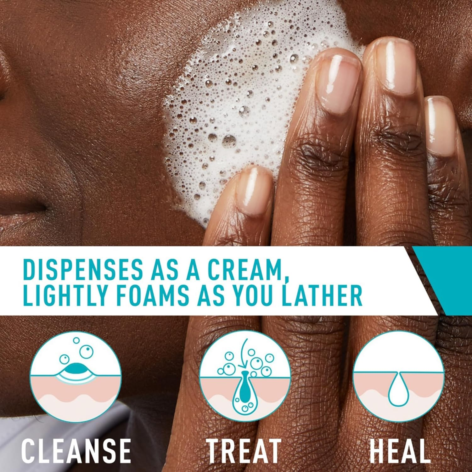 CeraVe Acne Foaming Cream Cleanser 150mL
